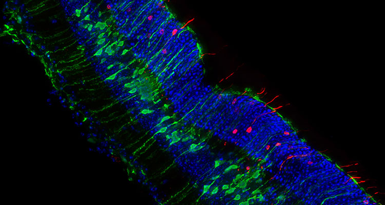 retinal close up